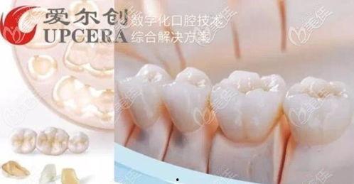 国产牙冠如何辨真伪视频